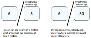 6 tips for a 6/6 Vision - Centre For Sight